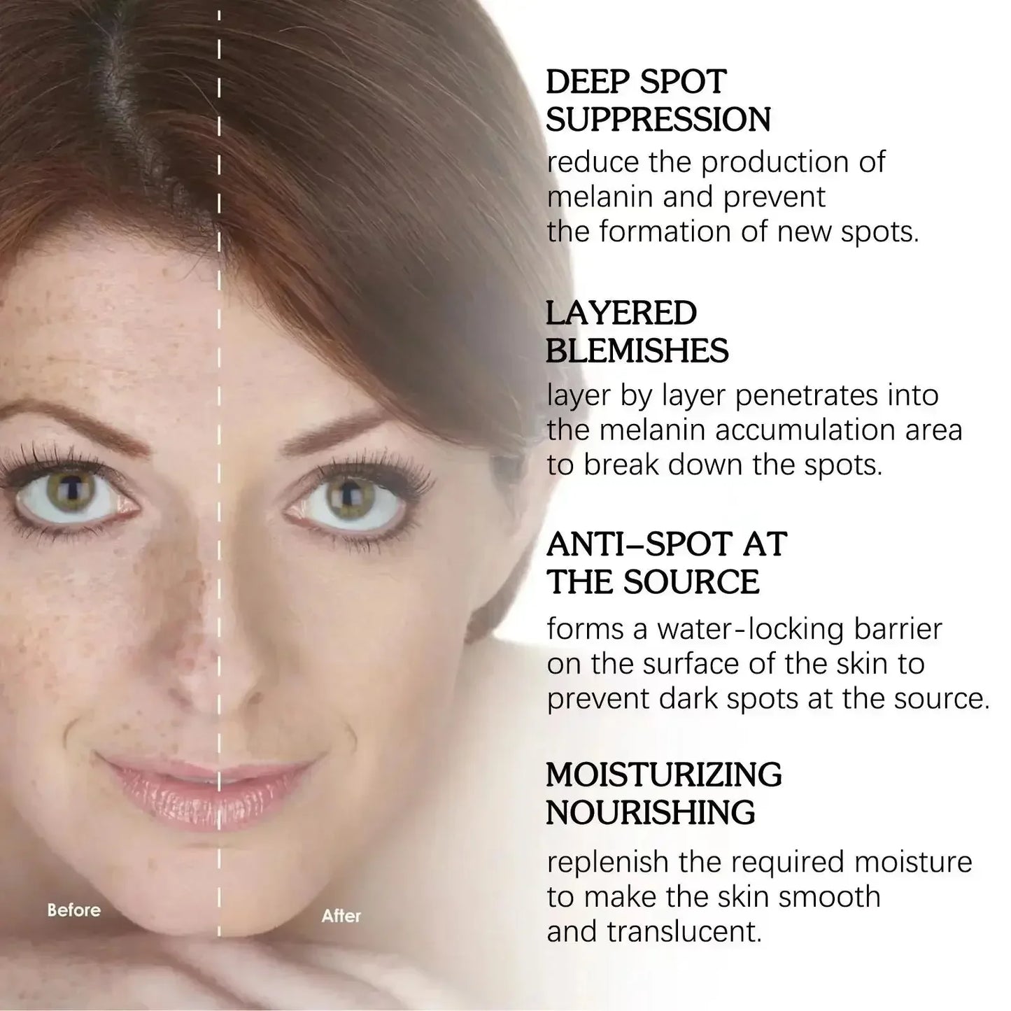 Dark Spot & Freckle Corrector Face Cream (Niacinamide + Vitamin C)