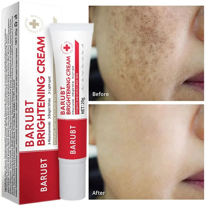 Dark Spot & Freckle Corrector Face Cream (Niacinamide + Vitamin C)