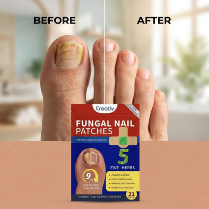 Repair Nail and Stop Yellow Fungus While You Sleep - Fungus Premium Patch